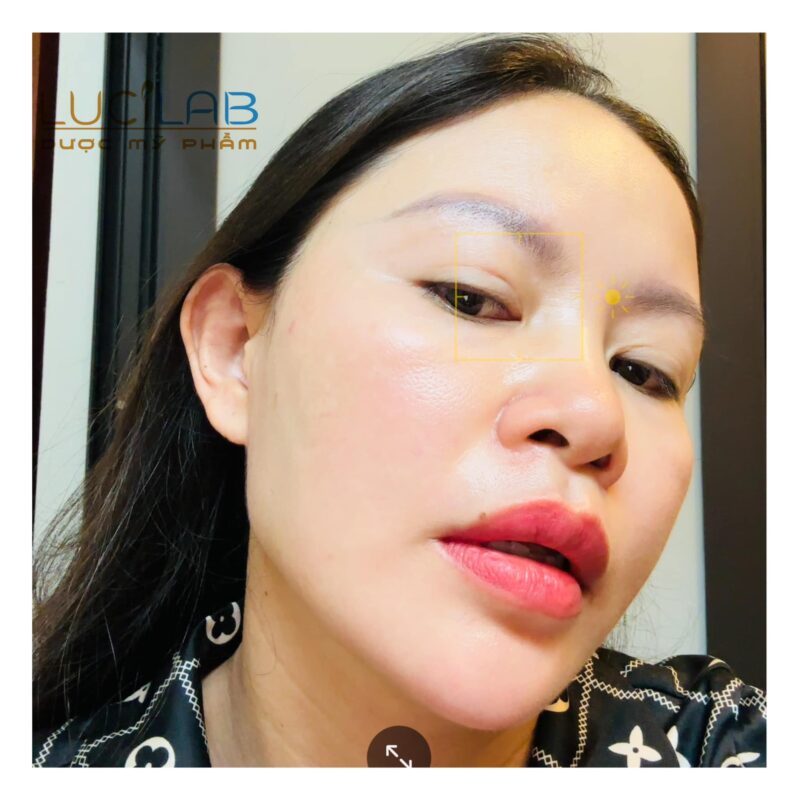 Phương Loan - của HIỆN TẠI sau khi ĐIỀU TRỊ NÁM THÀNH CÔNG